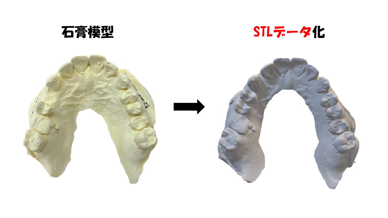 石膏模型をSTLデータに変換