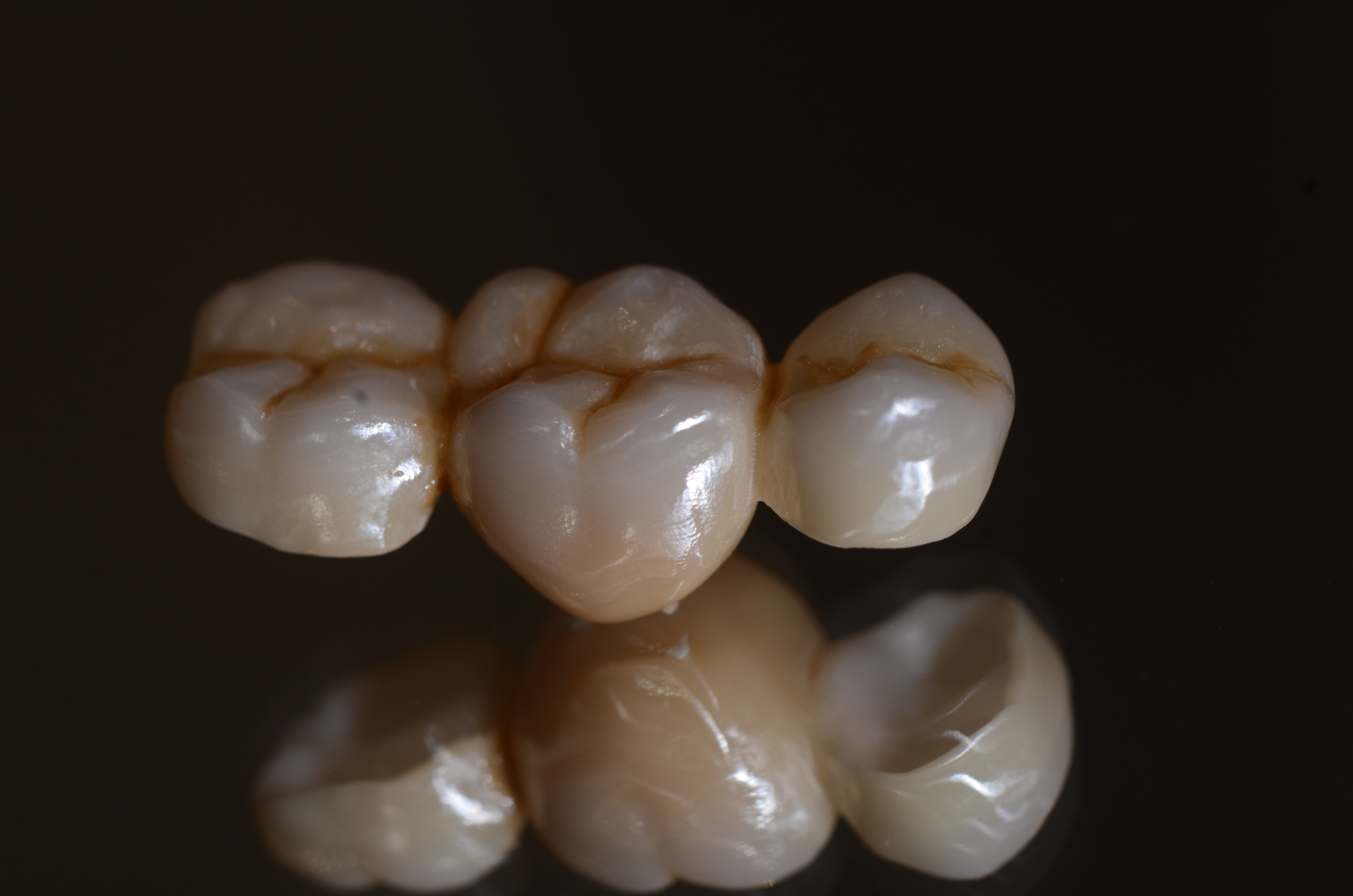 DT伊藤竜馬先生によるInlabによる設計のポイントからインフィルトレーション（色付け）＋ステイニングのハンズオンセミナー