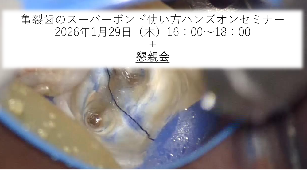 【懇親会参加の方用】亀裂歯のスーパーボンド使い方ハンズオンセミナー